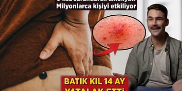 iceri-batan-kil-14-ay-yatalak-etti-9-sefer-sunduren-ameliyat-milyonlari-etkiliyor-ZC9UZjLL.jpg